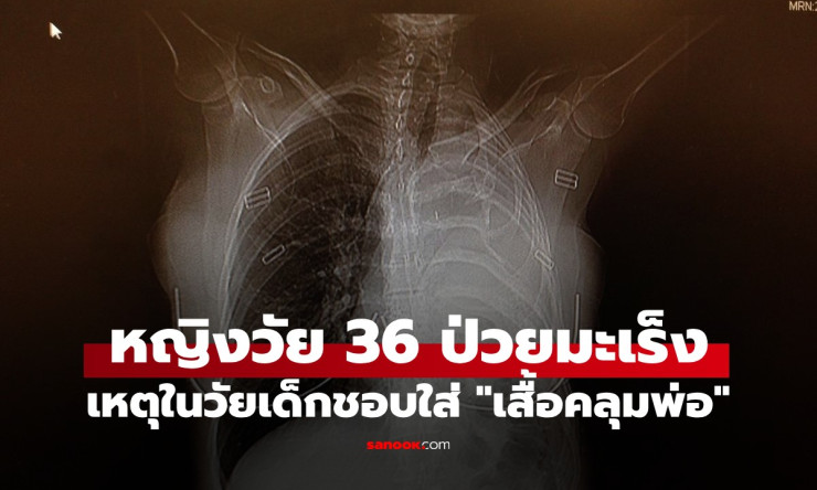 ช็อกสุดขีด! สาว 36 เจอมะเร็งร้ายจาก เสื้อคลุมพ่อ วัยเด็ก หมอบอกเหลือชีวิตแค่ 15 เดือน?! - fahbvip