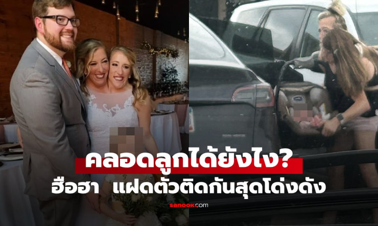 แฝดตัวติดกันคู่ดังของโลก มีลูกแล้ว! เผยวิธีตั้งครรภ์และคลอดที่ไม่ธรรมดา - fahbvip
