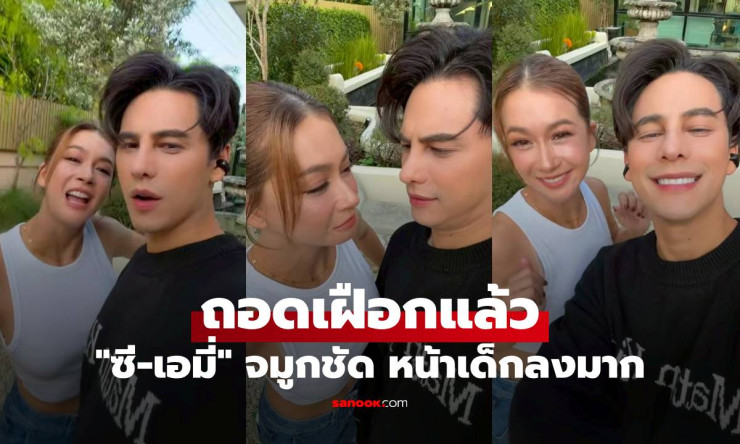 ซี-เอมี่ ถอดเฝือกแล้ว ศัลยกรรมแพ็กคู่ จมูกชัด หน้าเด็กลงมาก - fahbvip