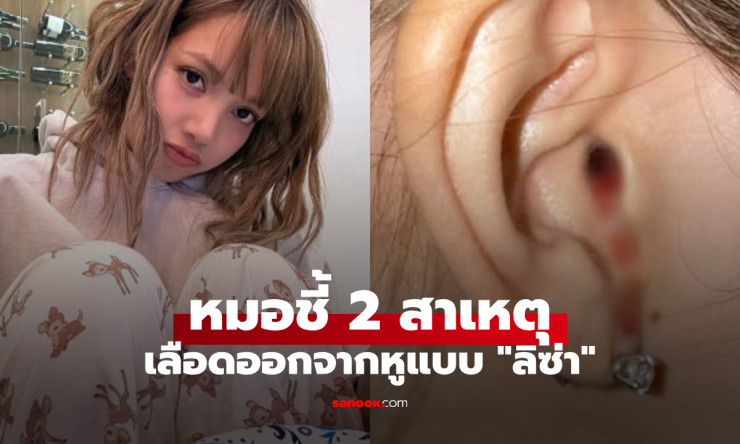 แพทย์เตือน 2 สาเหตุหลักเลือดไหลออกจากหูแบบลิซ่า พร้อมวิธีรับมือเมื่อเกิดอาการ - fahbvip