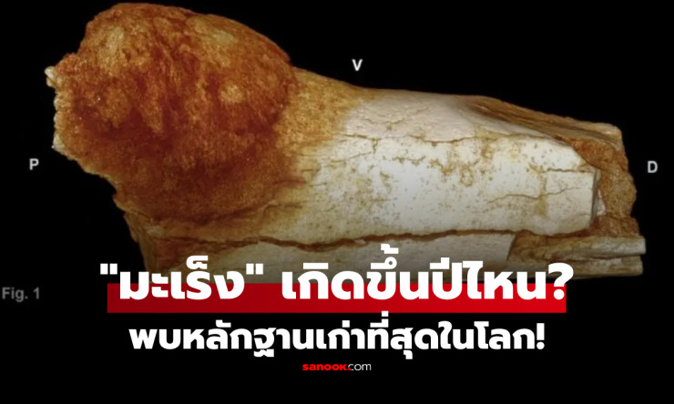 เปิดหลักฐานช็อกโลก! มะเร็งไม่ใช่โรคยุคใหม่ พบในฟอสซิลญาติมนุษย์อายุ 1.7 ล้านปี - fahbvip