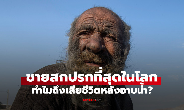 ไขข้อสงสัย ทำไมชายที่สกปรกที่สุดในโลก ถึงเสียชีวิตทันทีหลังอาบน้ำครั้งแรก - fahbvip