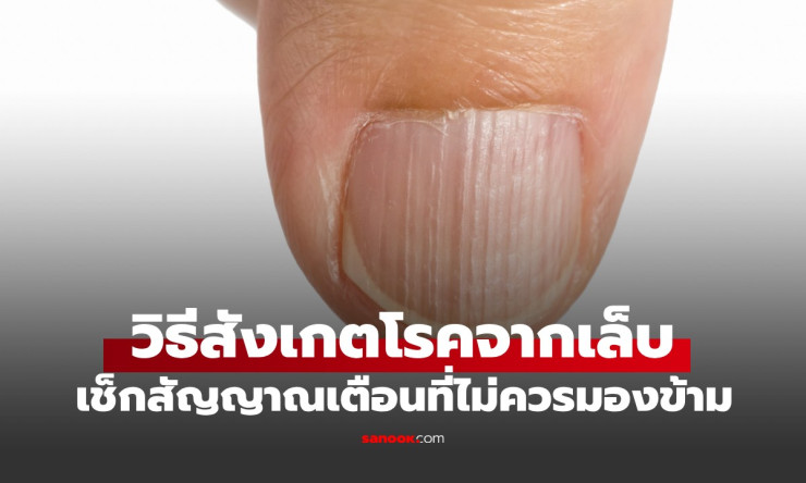 เล็บผิดรูป! สัญญาณเตือนร้ายจากร่างกายที่คุณมองข้ามไม่ได้ ตรวจด่วนก่อนสายเกิน! - fahbvip