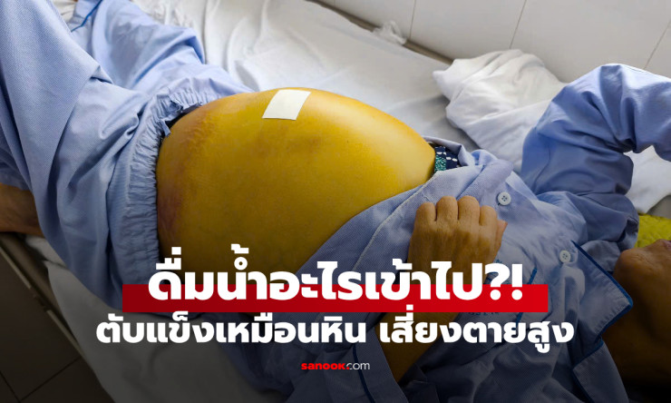 ไม่ใช่เหล้า หญิงนอนตัวเหลือง ตับแข็งเหมือนหิน เซ่นน้ำที่ดื่มเข้าไป แพทย์ชี้เสี่ยงตายสูง - fahbvip