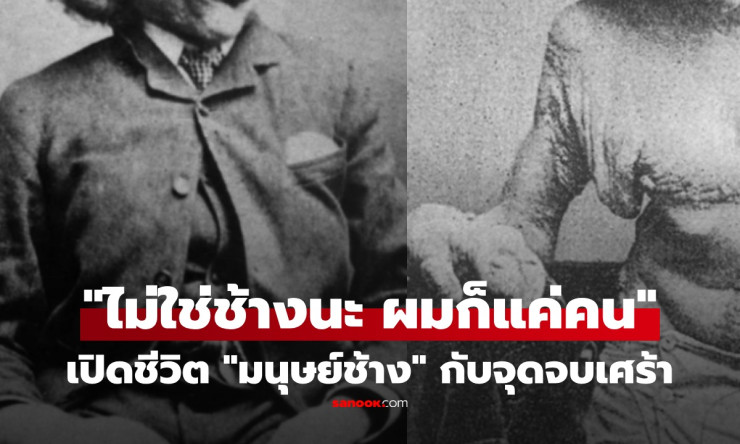 ช็อกทั้งโลก! ชีวิตมนุษย์ช้างสุดสะเทือนใจ ถูกตราหน้าว่า สัตว์ประหลาด แต่จิตใจดีกว่าคนปกติซะอีก! - fahbvip