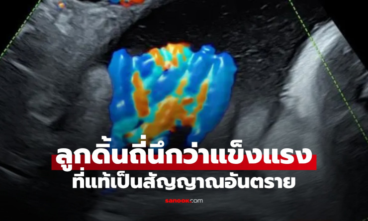 ระทึก! แม่ท้อง 37 สัปดาห์ ลูกดิ้นแรงทั้งคืน นึกว่าแข็งแรง ก่อนอัลตราซาวด์พบสายสะดือพันตัว 5 รอบ - fahbvip