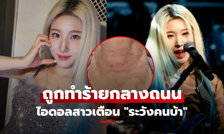 ช็อกสุดขีด! ไอดอลร็อกสาวเกาหลี โดนตีหน้า-คอเลือดอาบกลางถนน โพสต์เตือน ระวังคนบ้า แฟนกรี๊ดแตก! - fahbvip