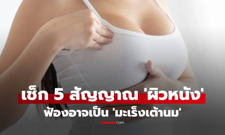 แพทย์เตือน! 5 สัญญาณผิวหนังฟ้อง มะเร็งเต้านม แม้คลำไม่เจอก้อน อย่าละเลย! - fahbvip