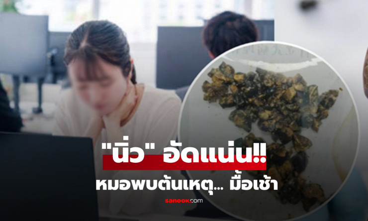 ช็อกหนัก! สาวกินมื้อเช้าแล้วปวดท้องยืนไม่อยู่ ผ่าเจอนิ่วถุงน้ำดีเต็มถังนับไม่ไหว แพทย์อึ้ง!! - fahbvip